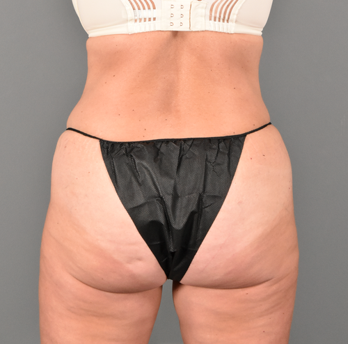 image-asset-1 after photo